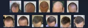 06_Collage_Tilt.jpg