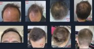 11_Before-After.jpg