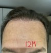 Hairline_12.jpg