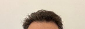 2024 dry hair afte 7 years.jpg