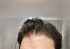 hairline - front.jpg