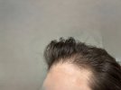 hairline - side.jpg