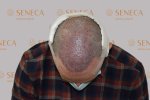 AFTER-(3)-(8) (1) (1).jpg