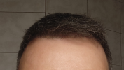 IMG_20250309_165602.png