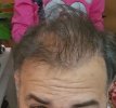 μπροστά πριν.jpg