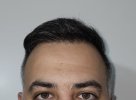 hairline.jpg