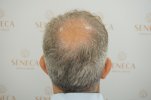 BEFORE (5).JPG