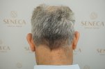BEFORE (6).JPG