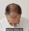 Before 2024.10 - 1.jpg