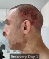 Recovery Day 1 - 1.jpg