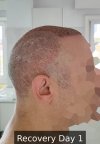 Recovery Day 1 - 2.jpg