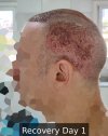 Recovery Day 1 - 4.jpg