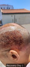 Recovery Day 1 - 6.jpg