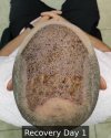 Recovery Day 1 - 8.jpg