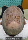 Recovery Day 1 - 9.jpg