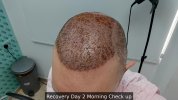 Recovery Day 2 Morning Check up - 0.jpg