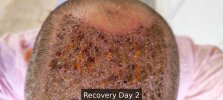 Recovery Day 2 - 2.jpg