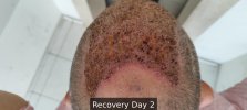 Recovery Day 2 - 3.jpg