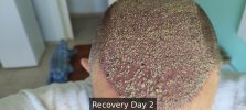 Recovery Day 2 - 4.jpg