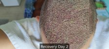 Recovery Day 2 - 5.jpg