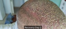 Recovery Day 2 - 6.jpg