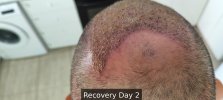 Recovery Day 2 - 7.jpg