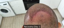 Recovery Day 2 - 8.jpg