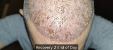 Recovery 2 End of Day - 9.jpg