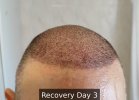 Recovery Day 3 - 2.jpg