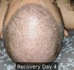 Recovery Day 4 - 3.jpg