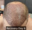 Recovery Day 6 - 1.jpg