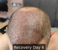 Recovery Day 6 - 2.jpg