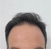 20250801_133517.png