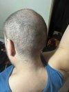 12 days after HS (2).jpg