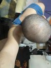 12 days after HS (3).jpg