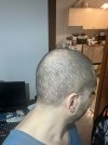 12 days after HS (4).jpg