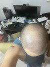 12 days after HS (5).jpg