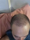 1 month after HS (8).jpg