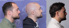 kolaj_3.png