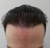 2DZ16.04.26F1.JPG