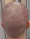 7DZ17.04.26P2.JPG