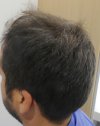 Pre-op 1-2.jpg
