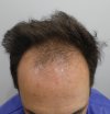 Pre-op 4.jpg