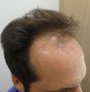 Pre-op 5.jpg