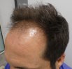 Pre-op 6.jpg