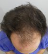 Pre-op 7-1.jpg
