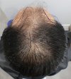 Pre-op 9-1.jpg