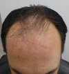 Pre-op 10.jpg