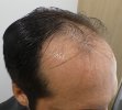 Pre-op 10-1.jpg