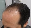 Pre-op 10-2.jpg